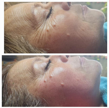 Asiácea™ CREMA FACIAL DE CENTELLA ASIATICA