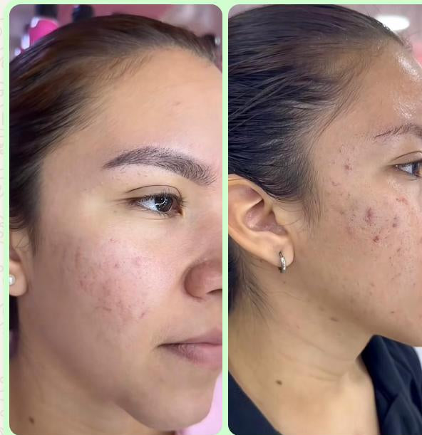 Asiácea™ CREMA FACIAL DE CENTELLA ASIATICA
